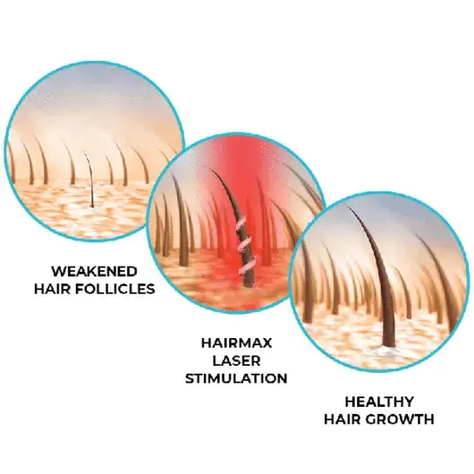 LASER 272 POWERFLEX CAP - Image 17