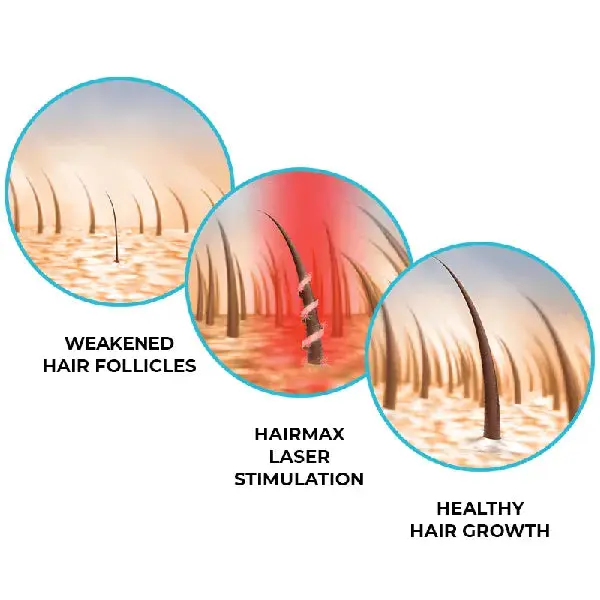 REGROW MD LASER 272 - Image 6